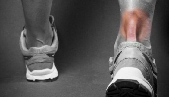 tratamientos para la tendinitis
